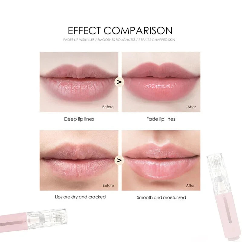 Enhance your lips with the Lip Roller- 105 Pin Microneedles with Serum Applicator for smooth, hydrated skin.